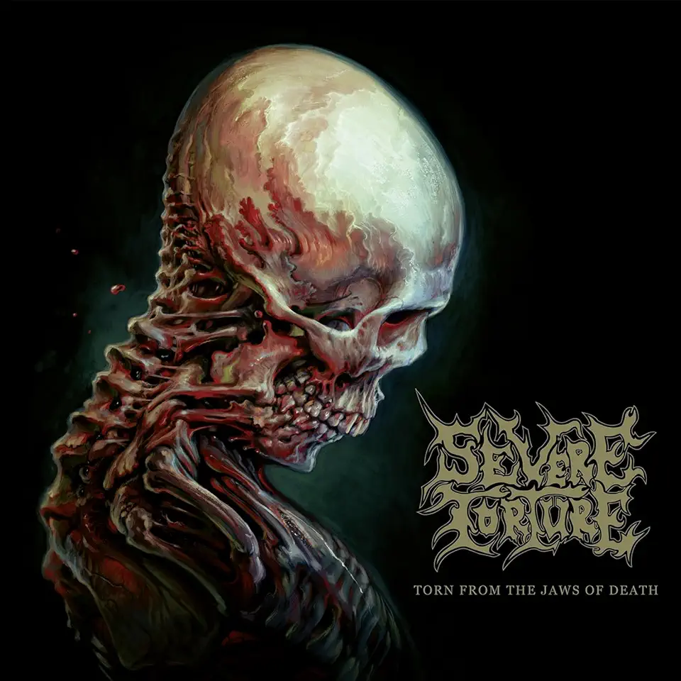 TORN FROM THE JAWS OF DEATH (LTD) (DIG)