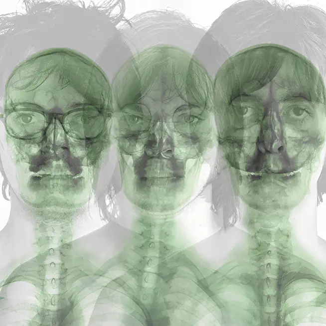 SUPERGRASS (DIG)