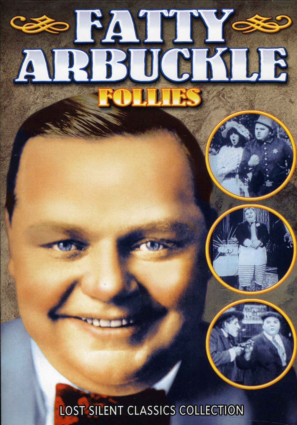 ARBUCKLE FOLLIES (SILENT) / (B&W)