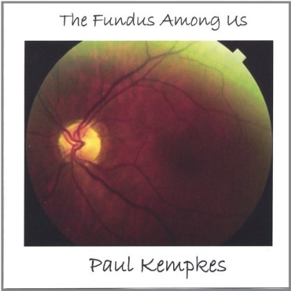 FUNDUS AMONG US